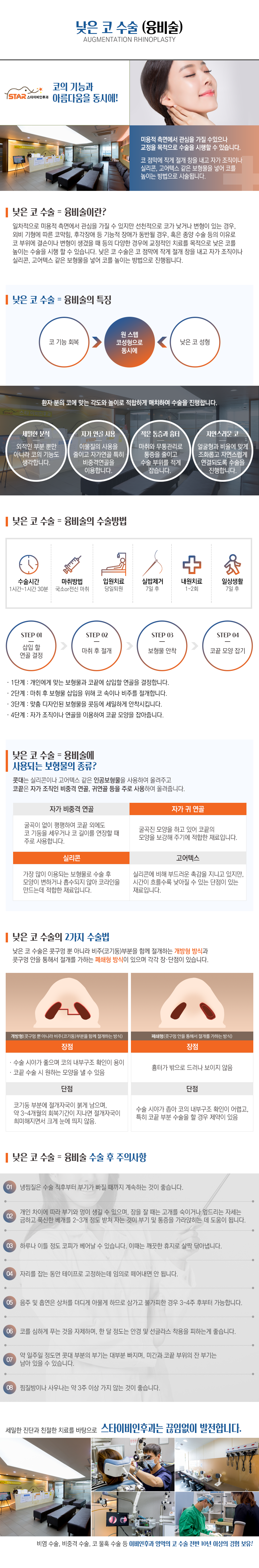 낮은코수술