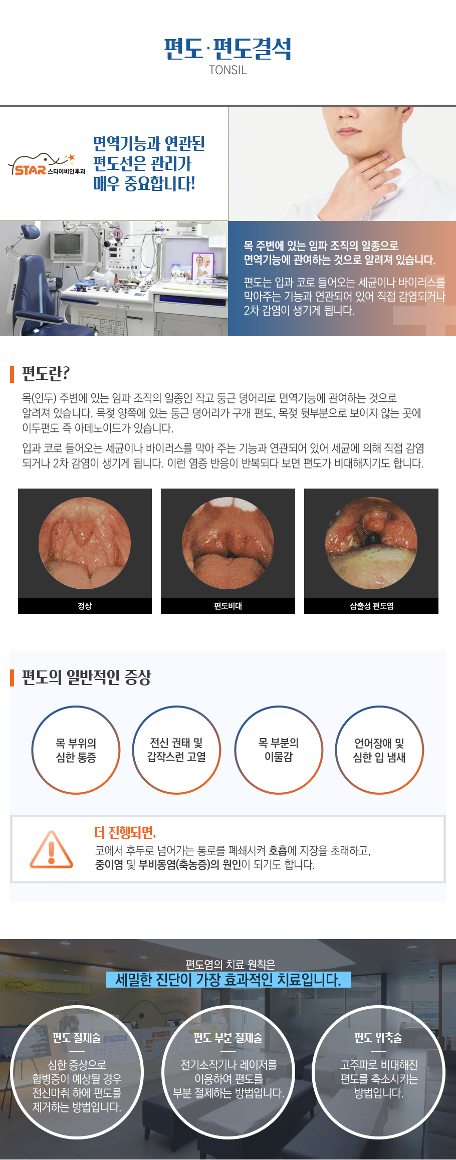편도