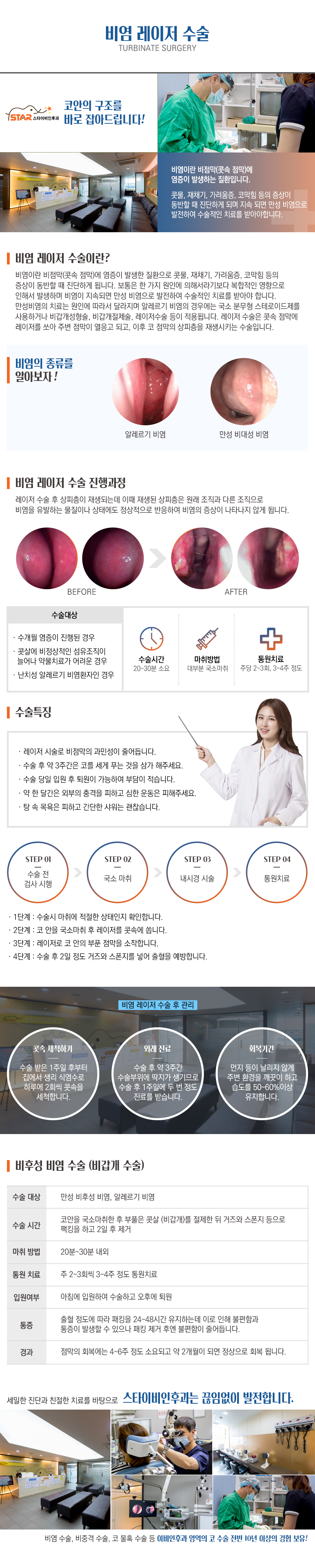 비염레이저수술