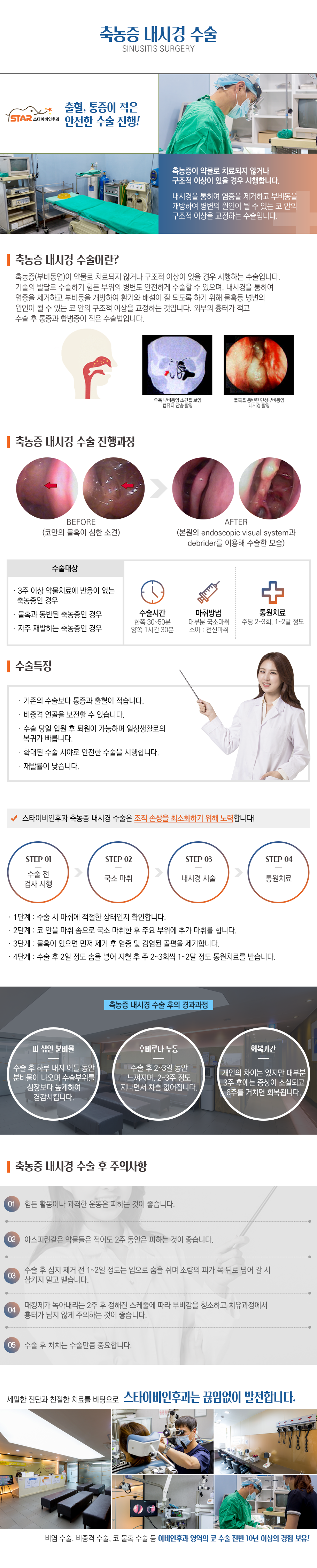 축농증내시경수술