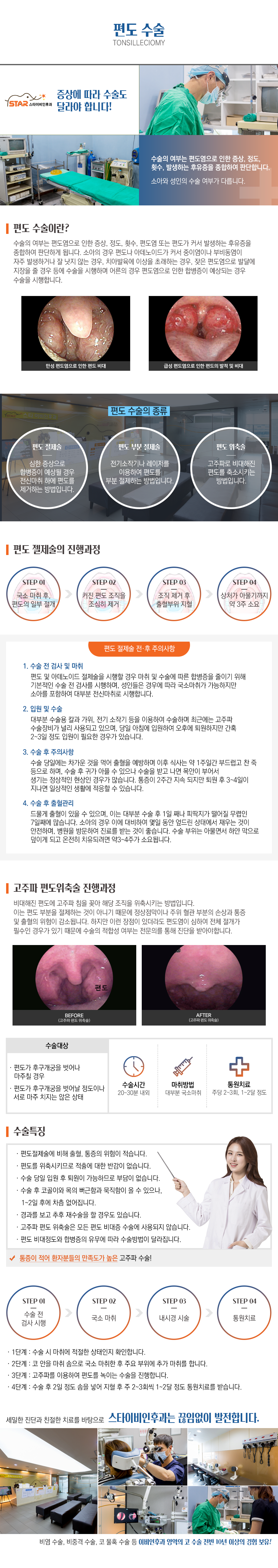 편도수술