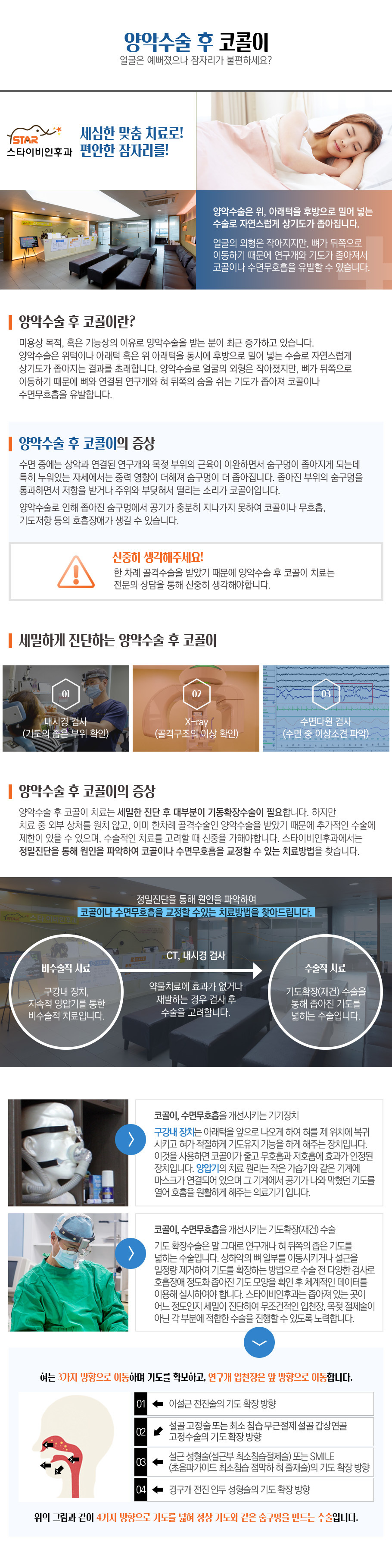 양악수술후코골이