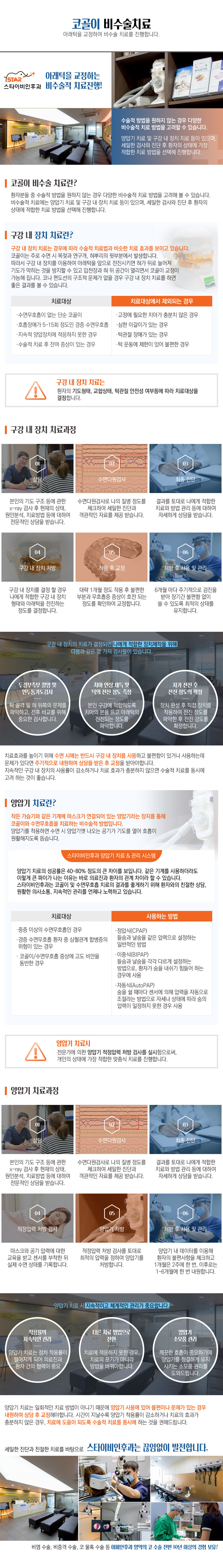 코골이 비수술적 치료