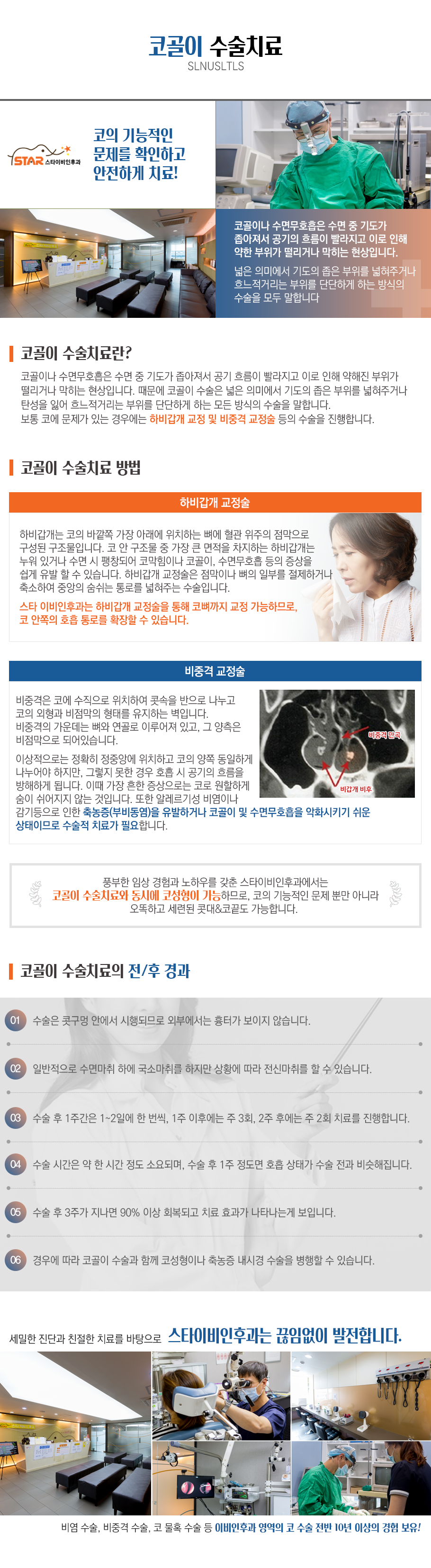 코골이 수술치료