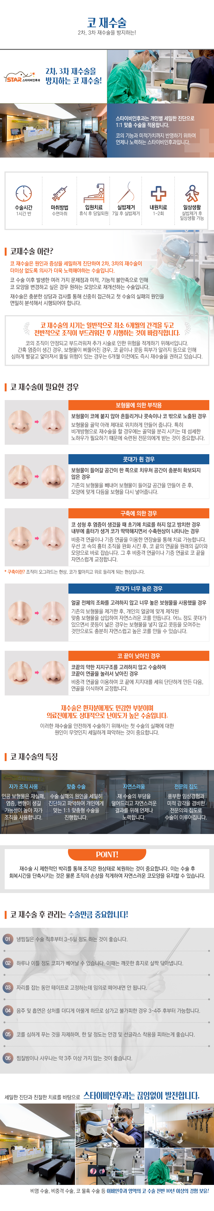 코 재수술